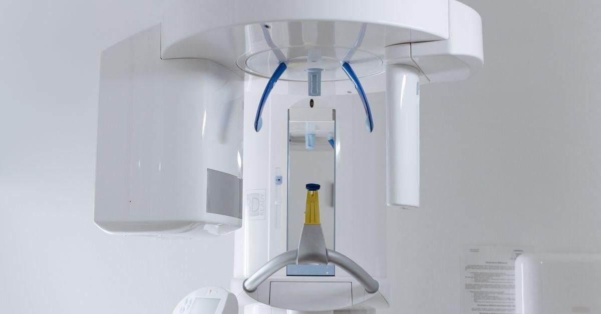 Edentulismo severo: implantes All-on-4 y All-on-6